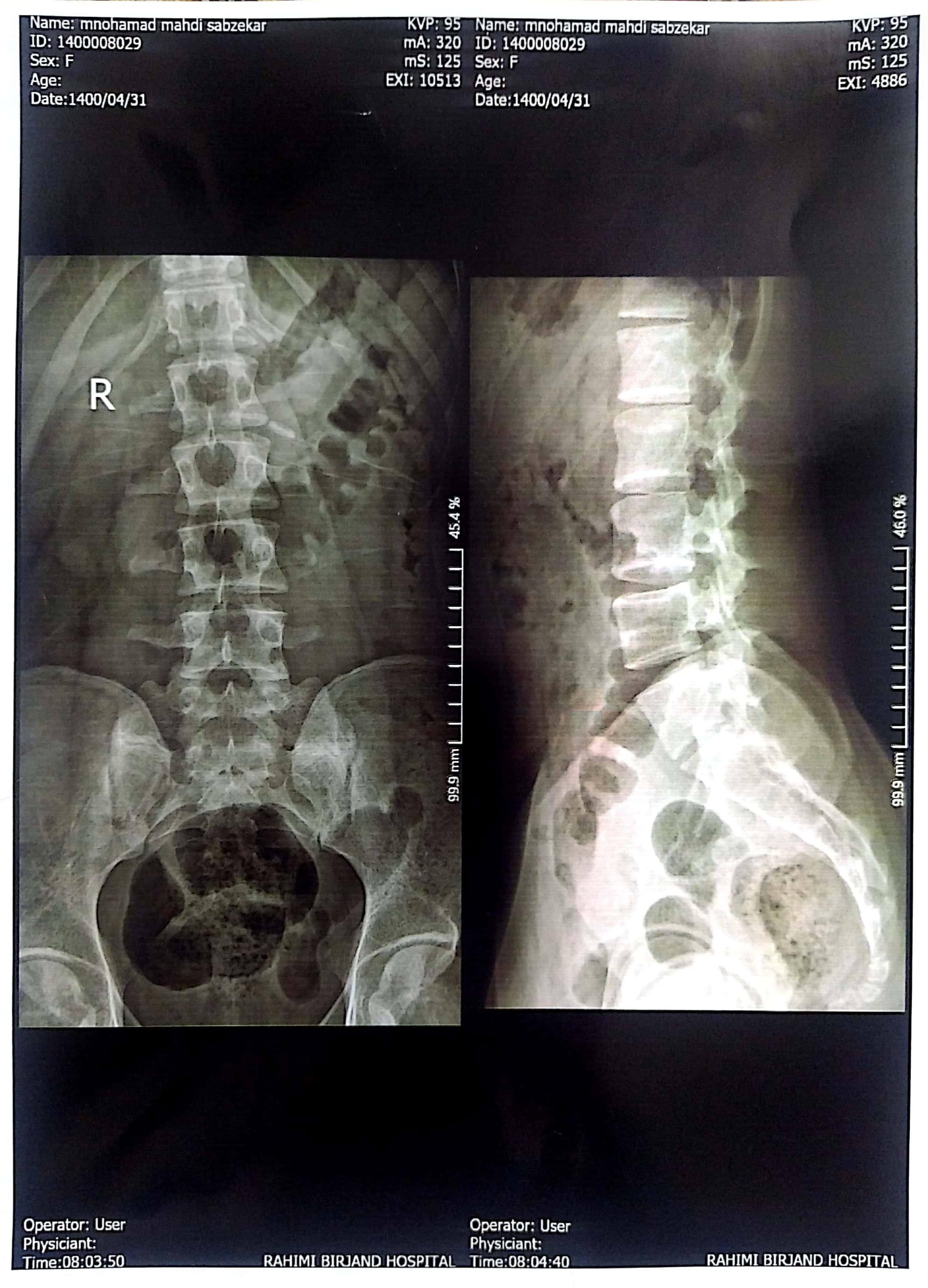 Other Prescribed Scans